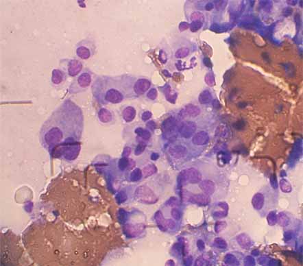 犬の形質細胞腫4